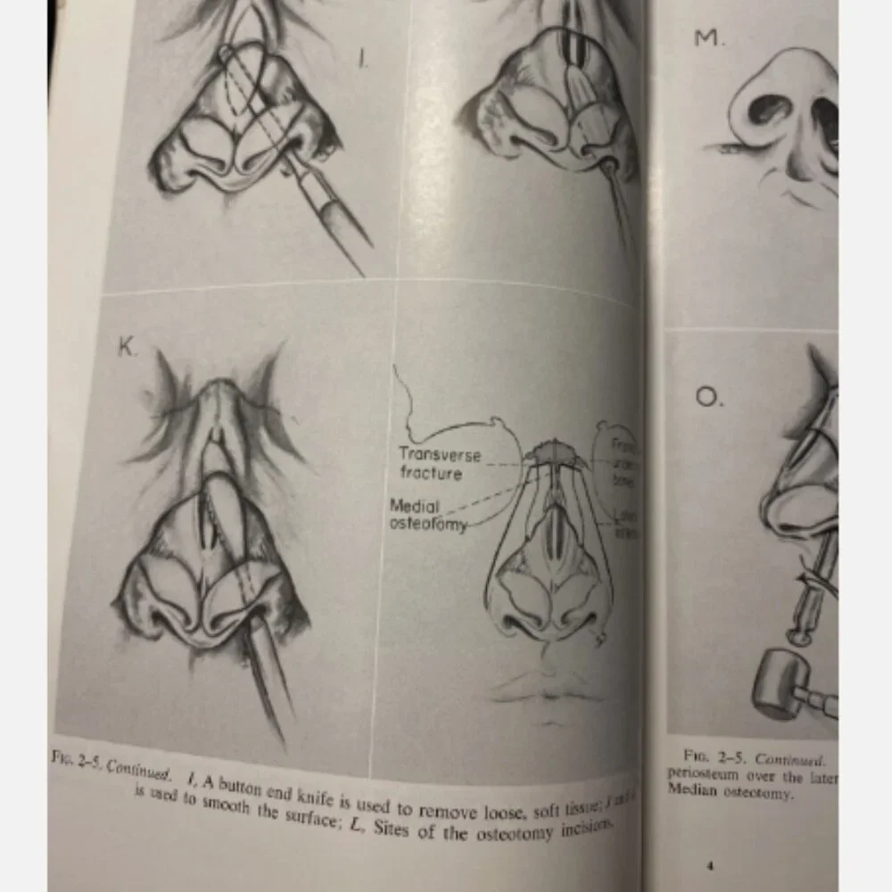 Diseases Of The Nose Throat And Ear 11th Ed John Jacob Ballenger